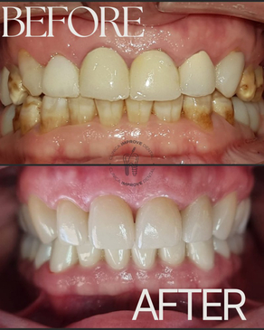 Slider image (3) Improve Dental